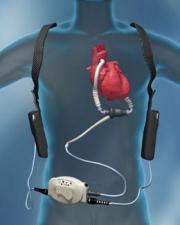 Cyborg Dick Cheney has no Heartbeat - Soon to be Wirelessly Powered